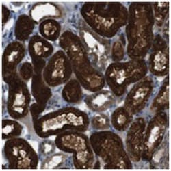 ZDHHC20 Rabbit anti-Human, Polyclonal Antibody, Abnova 100&mu;L; Unlabeled:Antibodies,