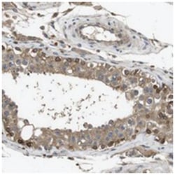 FZD10 Rabbit anti-Human, Polyclonal Antibody, Abnova 100&mu;L; Unlabeled:Antibodies,