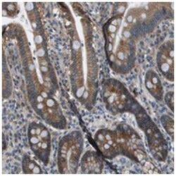 TMEM51, Rabbit, Polyclonal Antibody, Abnova 100&mu;L; Unlabeled:Antibodies,