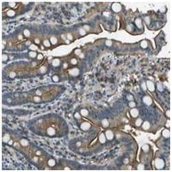 LRRC66 Rabbit anti-Human, Polyclonal Antibody, Abnova 100 &mu;L | Buy Online | Abnova Corporation | Fisher Scientific