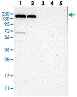 KIAA0355, Rabbit, Polyclonal Antibody, Abnova 100 &mu;L | Buy Online | Abnova Corporation | Fisher Scientific