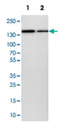 KIAA0355, Rabbit, Polyclonal Antibody, Abnova 100 &mu;L | Buy Online | Abnova Corporation | Fisher Scientific