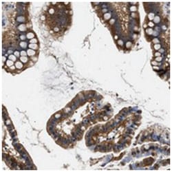 KIAA0355, Rabbit, Polyclonal Antibody, Abnova 100 &mu;L | Buy Online | Abnova Corporation | Fisher Scientific