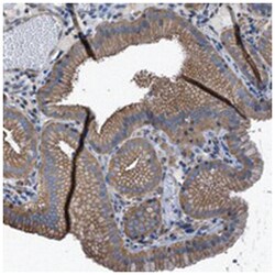 C9orf123, Rabbit, Polyclonal Antibody, Abnova 100&mu;L; Unlabeled:Antibodies,