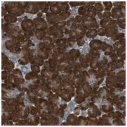 TMED9, Rabbit, Polyclonal Antibody, Abnova 100 &mu;L | Buy Online | Abnova Corporation | Fisher Scientific
