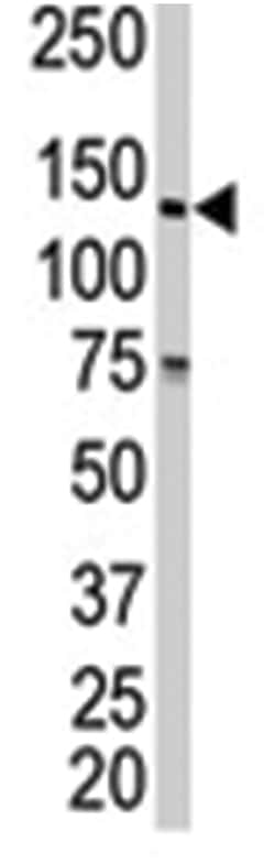 EGFR Rabbit anti-Human, Polyclonal Antibody, Abnova 400 &mu;L | Buy Online | Abnova Corporation | Fisher Scientific