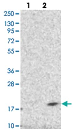 DPM3, Rabbit, Polyclonal Antibody, Abnova 100&mu;L; Unlabeled:Antibodies,
