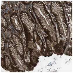 SFT2D1, Rabbit, Polyclonal Antibody, Abnova 100 &mu;L | Buy Online | Abnova Corporation | Fisher Scientific