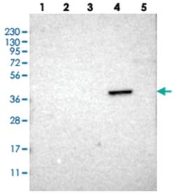 ZDHHC20 Rabbit anti-Human, Polyclonal Antibody, Abnova 100 &mu;L | Buy Online | Abnova Corporation | Fisher Scientific