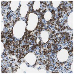 C19orf59, Rabbit, Polyclonal Antibody, Abnova 100&mu;L; Unlabeled:Antibodies,