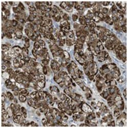 KCNC4, Rabbit, Polyclonal Antibody, Abnova 100 &mu;L | Buy Online | Abnova | Fisher Scientific