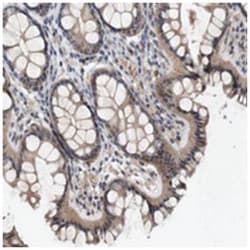 CYB561, Rabbit, Polyclonal Antibody, Abnova 100&mu;L; Unlabeled:Antibodies,