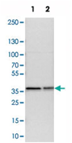 AQP4 Rabbit anti-Human, Mouse, Rat, Polyclonal Antibody, Abnova 100 &mu;L | Buy Online | Abnova Corporation | Fisher Scientific
