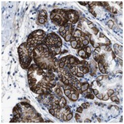 AQP4 Rabbit anti-Human, Mouse, Rat, Polyclonal Antibody, Abnova 100 &mu;L | Buy Online | Abnova Corporation | Fisher Scientific