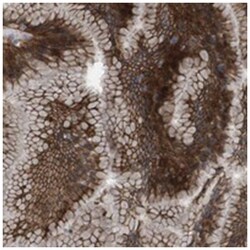 KIDINS220 Rabbit anti-Human, Polyclonal Antibody, Abnova 100 &mu;L | Buy Online | Abnova Corporation | Fisher Scientific