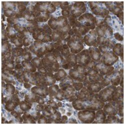CLPTM1L, Rabbit, Polyclonal Antibody, Abnova 100 &mu;L | Buy Online | Abnova Corporation | Fisher Scientific