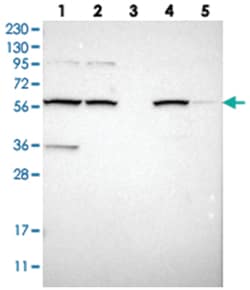 MBOAT2, Rabbit, Polyclonal Antibody, Abnova 100 &mu;L | Buy Online | Abnova Corporation | Fisher Scientific