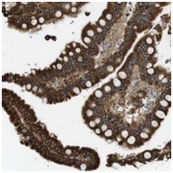 MBOAT2, Rabbit, Polyclonal Antibody, Abnova 100 &mu;L | Buy Online | Abnova Corporation | Fisher Scientific