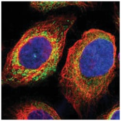 MPDU1, Rabbit, Polyclonal Antibody, Abnova 100&mu;L; Unlabeled:Antibodies,