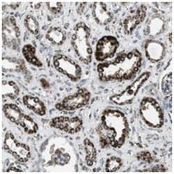 KCNE3 Rabbit anti-Human, Polyclonal Antibody, Abnova 100&mu;L; Unlabeled:Antibodies,