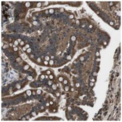 SSR3, Rabbit, Polyclonal Antibody, Abnova 100&mu;L; Unlabeled:Antibodies,