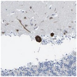 PDZK1IP1, Rabbit, Polyclonal Antibody, Abnova 100 &mu;L | Buy Online | Abnova Corporation | Fisher Scientific