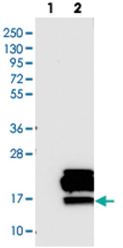 PDZK1IP1, Rabbit, Polyclonal Antibody, Abnova 100 &mu;L | Buy Online | Abnova Corporation | Fisher Scientific
