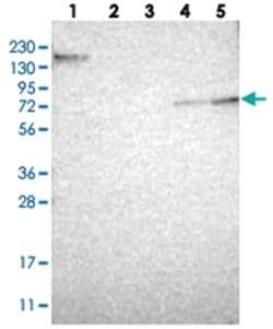 CNGA2 Rabbit anti-Human, Polyclonal Antibody, Abnova 100&mu;L; Unlabeled:Antibodies,