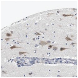 CNGA2 Rabbit anti-Human, Polyclonal Antibody, Abnova 100&mu;L; Unlabeled:Antibodies,