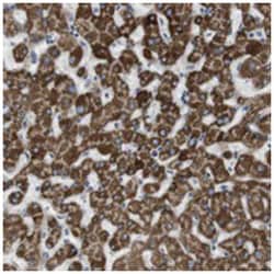 MARC2. Rabbit anti-Human, Polyclonal Antibody, Abnova 100&mu;L; Unlabeled:Anticuerpos