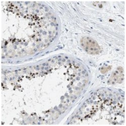 C9orf11 Rabbit anti-Human, Polyclonal Antibody, Abnova 100&mu;L; Unlabeled:Antibodies,