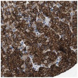 DENND4C Rabbit anti-Human, Polyclonal Antibody, Abnova 100&mu;L; Unlabeled:Antibodies,