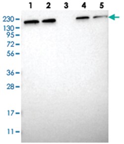 UGCGL1 Rabbit anti-Human, Polyclonal Antibody, Abnova 100 &mu;L | Buy Online | Abnova | Fisher Scientific