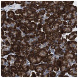 UGCGL1 Rabbit anti-Human, Polyclonal Antibody, Abnova 100 &mu;L | Buy Online | Abnova | Fisher Scientific