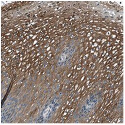 LRRC37B Rabbit anti-Human, Polyclonal Antibody, Abnova 100&mu;L; Unlabeled:Antibodies,