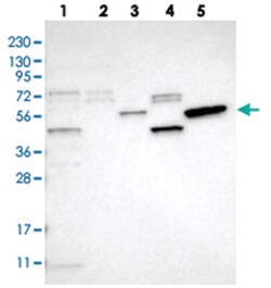 SLC41A1, Rabbit, Polyclonal Antibody, Abnova 100&mu;L; Unlabeled:Antibodies,