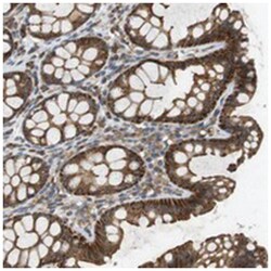 SLC41A1, Rabbit, Polyclonal Antibody, Abnova 100&mu;L; Unlabeled:Antibodies,