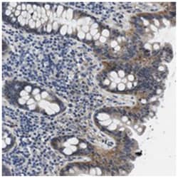 SLC30A1, Rabbit, Polyclonal Antibody, Abnova 100 &mu;L | Buy Online | Abnova Corporation | Fisher Scientific