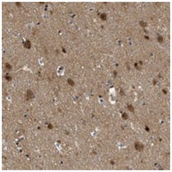 ZBTB11 Rabbit anti-Human, Polyclonal Antibody, Abnova 100&mu;L; Unlabeled:Antibodies,
