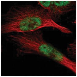 ZBTB11 Rabbit anti-Human, Polyclonal Antibody, Abnova 100&mu;L; Unlabeled:Antibodies,