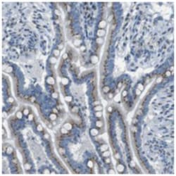 TXNDC15, Rabbit, Polyclonal Antibody, Abnova 100 &mu;L | Buy Online | Abnova Corporation | Fisher Scientific