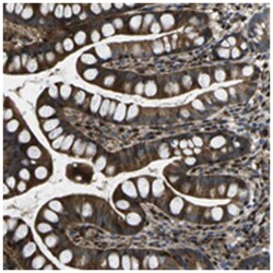 PLCE1 Rabbit anti-Human, Polyclonal Antibody, Abnova 100 &mu;L | Buy Online | Abnova Corporation | Fisher Scientific