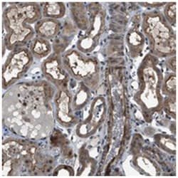 TMEM132C Rabbit anti-Human, Polyclonal Antibody, Abnova 100&mu;L; Unlabeled:Antibodies,