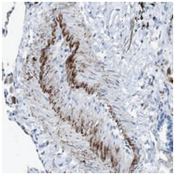 APOBEC4 Rabbit anti-Human, Polyclonal Antibody, Abnova 100 &mu;L | Buy Online | Abnova Corporation | Fisher Scientific