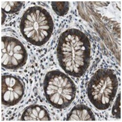 TMEM74, Rabbit, Polyclonal Antibody, Abnova 100&mu;L; Unlabeled:Antibodies,