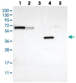 TMEM74, Rabbit, Polyclonal Antibody, Abnova 100&mu;L; Unlabeled:Antibodies,