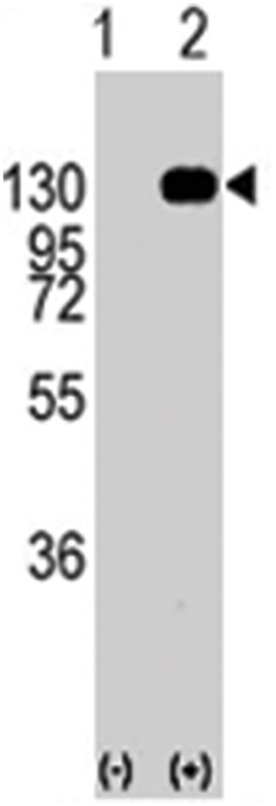 FGFR1 Rabbit anti-Human, Polyclonal Antibody, Abnova 400&mu;L; Unlabeled:Antibodies,