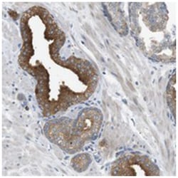 B4GALNT2, Rabbit, Polyclonal Antibody, Abnova 100 &mu;L | Buy Online | Abnova Corporation | Fisher Scientific