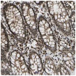 SPEN, Rabbit, Polyclonal Antibody, Abnova 100&mu;L; Unlabeled:Antibodies,