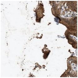 TRAK2 Rabbit anti-Human, Polyclonal Antibody, Abnova 100 &mu;L | Buy Online | Abnova Corporation | Fisher Scientific